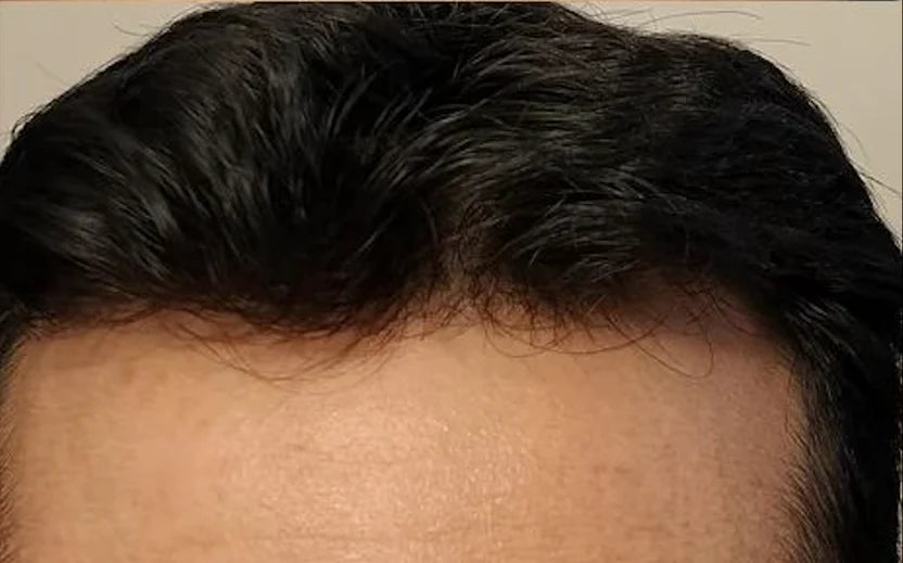 Na